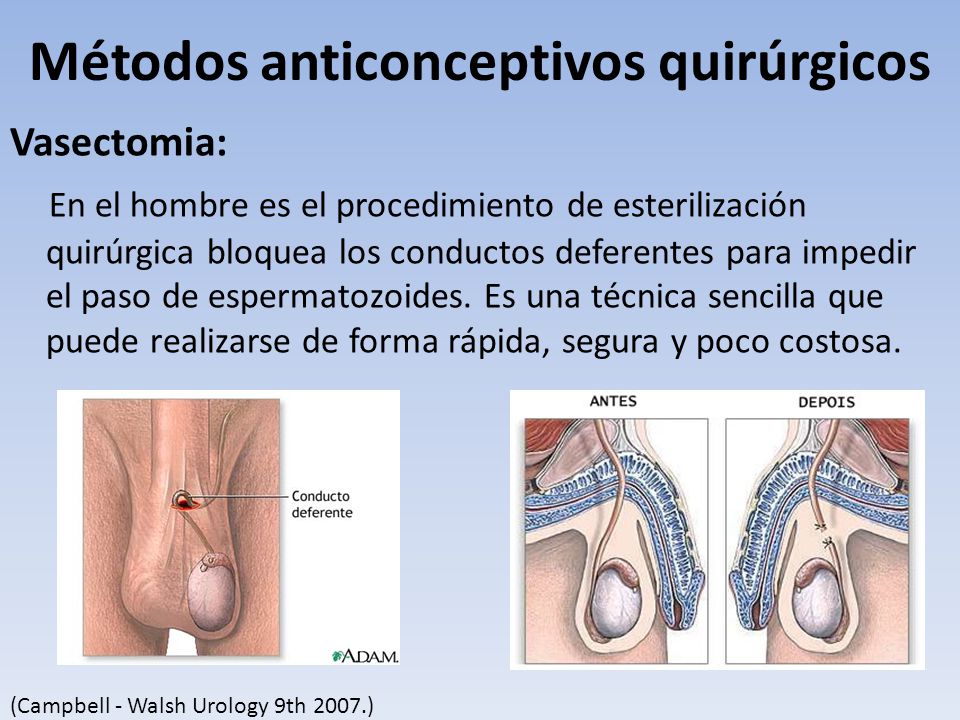 BPH ( Y HUYLU PROSTAT B Y MES )